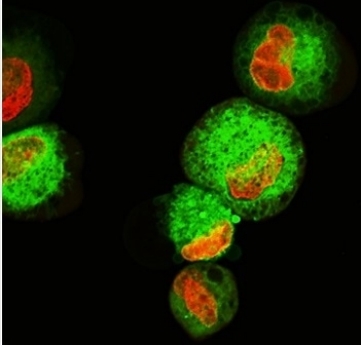 Bimolecular fluorescence complementation BiFC